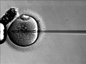 Fecundación in Vitro (FIV-ICSI) 