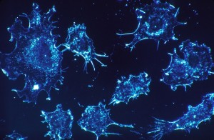 1280px-Cancer_cells