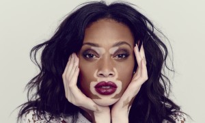 Chantelle winnie.jpg 2